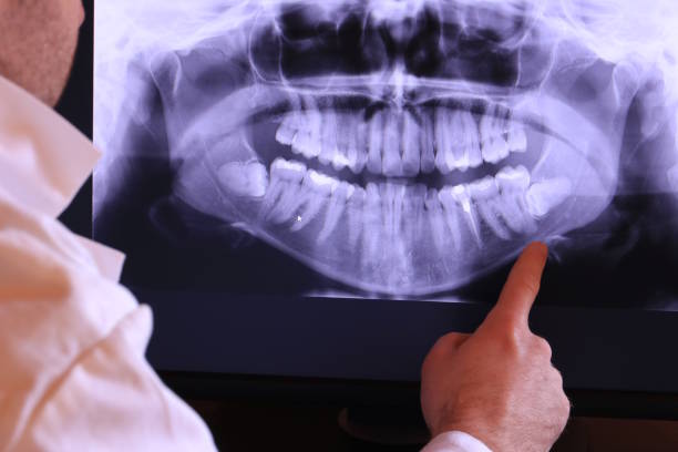 Best Dentist for Tooth Abscess  in Hilliard, OH