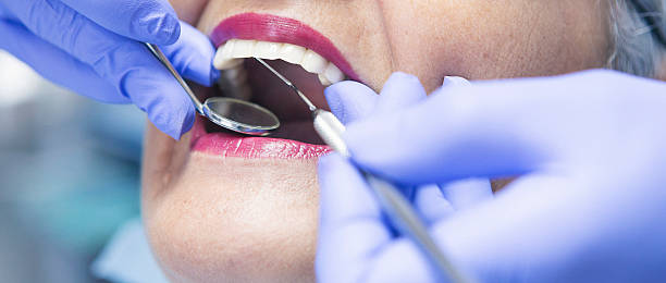 Best Urgent Tooth Repair  in Hilliard, OH